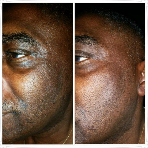 Skin Care Results